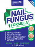 Nails Fungus Formula - 16 oz